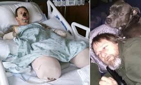 Check spelling or type a new query. Wisconsin Man Who Lost All His Limbs To Dog Lick Faces More Surgeries Daily Mail Online