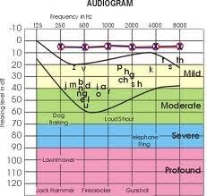 A completed audiogram will have xs and os on it. The Next Chapter In My Speech World How To Read An Audiogram