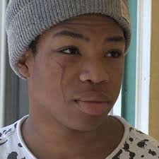 WATCH: Gay Teens Say Classmates Attacked Them With Screwdriver