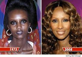 Black Celebrities Who Have Allegedly Bleached Their Skin Bossip Beyonce Skin Skin Bleaching Skin Lightening Cream