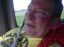 Canby Men's Softball League History