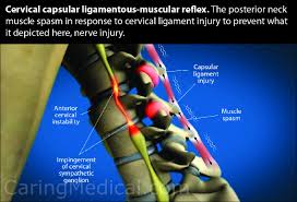 Bones of the shoulder and arm. Cervical Vertigo And Cervicogenic Dizziness Caring Medical Florida