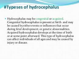 Hydrocephalus Rehabilitation Therapy Subdural Hematoma Genetic Abnormalities