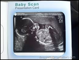 3d 4d ultrasound baby scan window to the womb ltd baby scan hire 3d and 4d ultrasound services to have clear images of your unborn baby ultrasound pictures ultrasound 3d ultrasound pictures. Our 20 Week Scan Mummy Matters