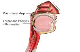 First of all you need a spray bottle. Post Nasal Drip Wikipedia