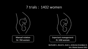 Image result for Manual Rotation in Occipitoposterior Presentation