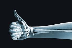 Keep Your Body Happy Be Sure To Promote Your Proper Bone Health Bone Health Healthy Bones Food For Strong Bones