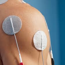 Image result for Shoulder Subluxation