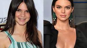 See more of kendall jenner on facebook. Kendall Jenner So Hat Sich Das Model Verandert