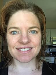 My first Rhonda Allison peel: 7 day journal