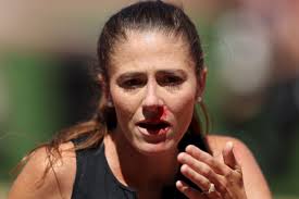 Helen Schlachtenhaufen Has a Bloody Fall at U.S. Championships