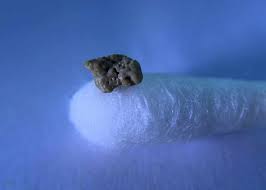 Black And White Spots On Tonsils Pin On Wellness