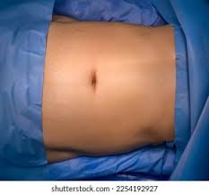 Image result for Umbilicus