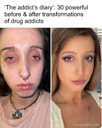 The addict's diary': 30 powerful before & after transformations of drug  addicts (link in the comments)