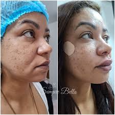 𝗦𝗘𝗠𝗣𝗥𝗘 𝗕𝗘𝗟𝗟𝗔