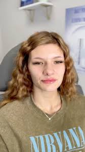 Plump it up! 💋✨ Loving my new lip look! #LipFiller #Kissable #BeautyGoals  #flawlessmedspabryant