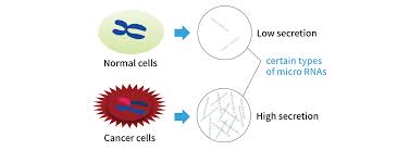 Blood tests cant detect cancers as such, however they are used as tools alongside several other investigative modalities to aid in the diagnosis. Toshiba S Microrna Technologies Rapidly Detect 13 Cancer Types From Micro Blood Sample