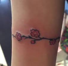 The light waves from the lasers warm up the particles to dismantle them into tiny pieces and allow your immune system to take it out of your body. I Removed My Tattoo By Excision Vancouver Bc Review Realself