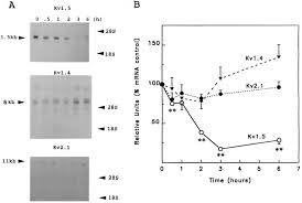 We did not find results for: Membrane Depolarization Inhibits Kv1 5 Voltage Gated K Channel Gene Transcription And Protein Expression In Pituitary Cells Journal Of Biological Chemistry
