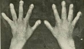 The Murderer S Thumb A Short History Wonders Marvels