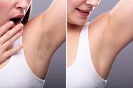 It's important to note that no documented cases of cancer or other devastating illnesses have been associated with laser hair removal at this point, but it's. Laser Treatments Bb Royal Cosmetic