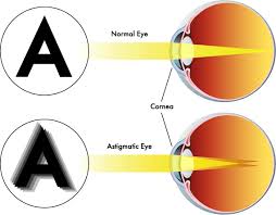 They are not different eye shapes, they are different eyelids. Astigmatism Seeport Optometry