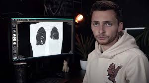 »im schlimmsten fall sterbe ich halt«. Youtube Star Philipp Mickenbecker Der Tumor Verschiebt Das Herz