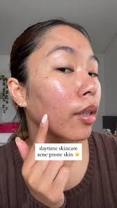 this routine is what has helped heal my acne lately 🥹, --,  @medicube_global_official hypochlorous acid spray, @muradskincare  biome-balancing acne treatment serum, @purito_official oat-in calming gel,  ...