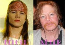 Axl Rose
