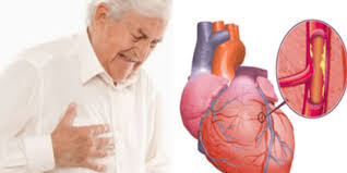 Upaya yang harus dilakukan agar tidak terkena gangguan penyakit pada sistem reproduksi manusia. Berbagai Gangguan Sistem Peredaran Darah Manusia Dan Upaya Pencegahannya