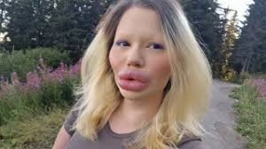 Woman poses in her underwear to show off her stoma bag and body confidence 