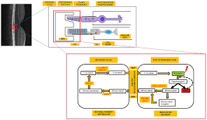 Choose contactless pickup or delivery today. Voretigene Neparvovec And Gene Therapy For Leber S Congenital Am Tacg