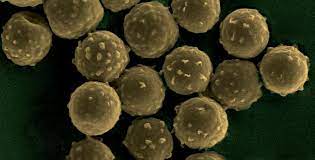 Sie betrifft häufig das atemwegssystem wie bronchien und lungen, kann jedoch auch auf andere organe übergehen. Aspergillose Informations Et Traitements Institut Pasteur
