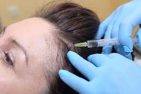 Mix a few drops of rosemary oil into a carrier oil and massage it into your hair and scalp before rinsing. Prp Hair Regrowth Treatments At Advanced Image Med Spa Elite Wellness Center In Glendale Az