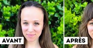 Des parents ont fait opérer leur fille pour enlever une tache de naissance  rare, car “les gens l'auraient dévisager”