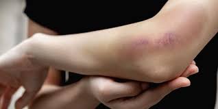 Penelitian menunjukkan tanaman ini memiliki manfaat kesehatan dan mampu mengatasi berbagai penyakit. 9 Ciri Ciri Liver Bermasalah Halaman All Kompas Com