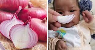 Penyebabnya bisa jadi flu biasa, bukan infeksi yang sebenarnya. Petua Dari Mekah Untuk Rawat Selesema Hidung Tersumbat Kahak Pada Bayi Hanya Guna Bawang Merah Sahaja Terlajak Mudah Ni Keluarga