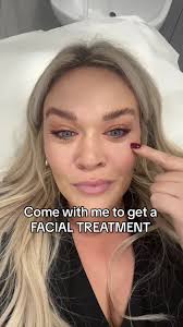 Polynucleotides Facial Treatment Experience at Therapie Clinic