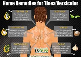 These yeasts are normally found on the human skin and become troublesome only under certain circumstances, such as a warm and humid environment, alt. Tinea Versicolor