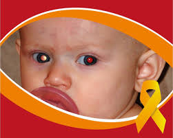 Image result for Red Reflex