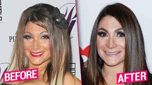 Jerry kennard, phd, is a psychologist and associate fellow of the british psychological society. Jersey Shore Cast S Shocking Plastic Surgery Transformations Revealed