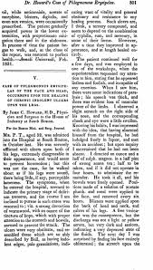 Image result for phlegmon on face)