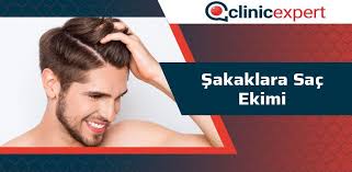Sakaklara Sac Ekimi Clinicexpert Uluslararasi Saglik Hizmetleri