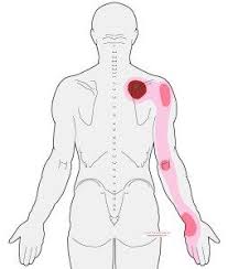 Pin On Body Parts