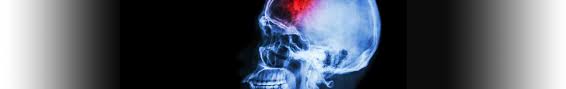 Emergency nursing ceu courses emergency nursing continuing education courses focus on best practices for emergency nurses. Stroke Ceu Online Continuing Education Course