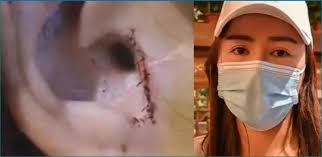 The other game involves descriptions of parts of the body and you need to name them (parts of the body description game). Woman Returns Home After Undergoing Nose Surgery And Found This Body Part Missing Newstrack English 1