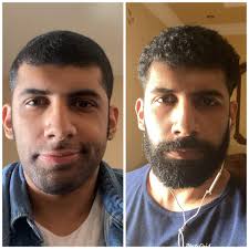 Jag behöver en åsikt. Vilket ser bättre ut? Med skägg eller utan? : r/beards