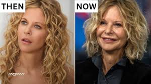 Meg Ryan's Mysterious Face Transformation