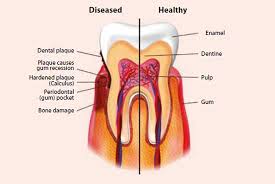 If you notice receding gums and you. Conditions Treatments Singhealth