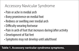 Accessory Navicular Syndrome Caring Medical Florida